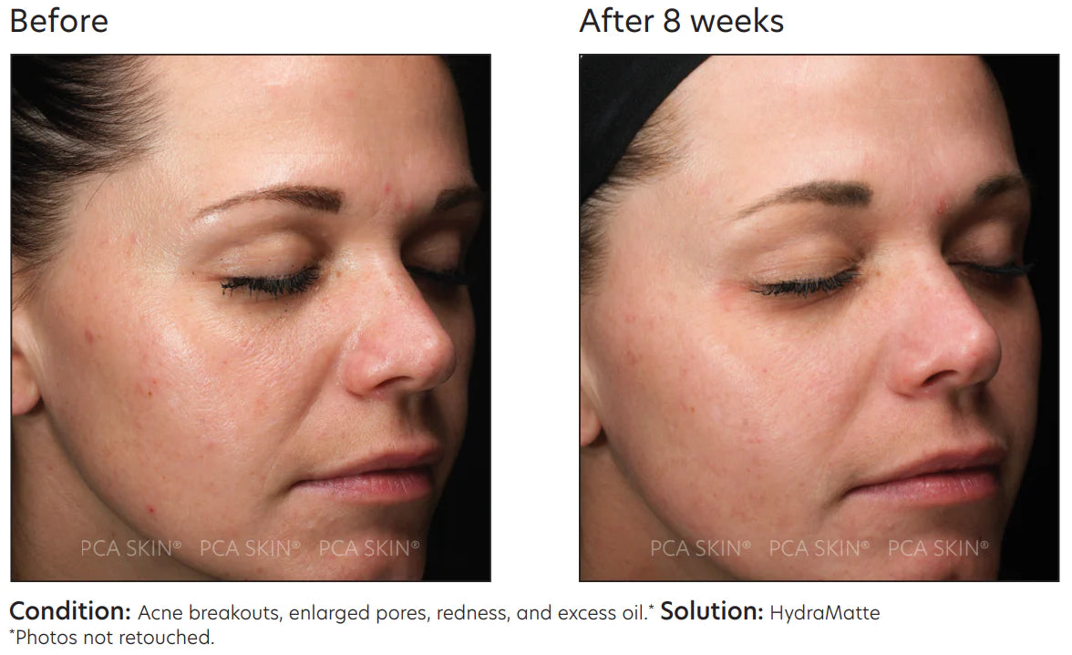 PCA Skin HydraMatte 51g