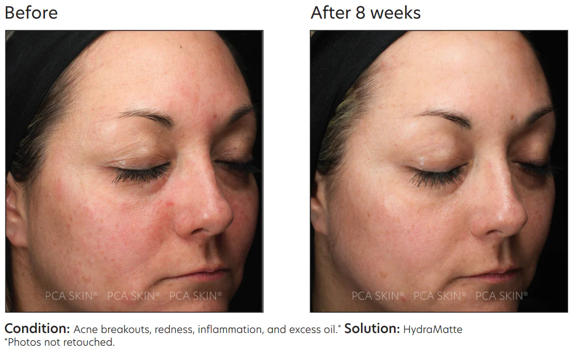 PCA Skin HydraMatte 51g