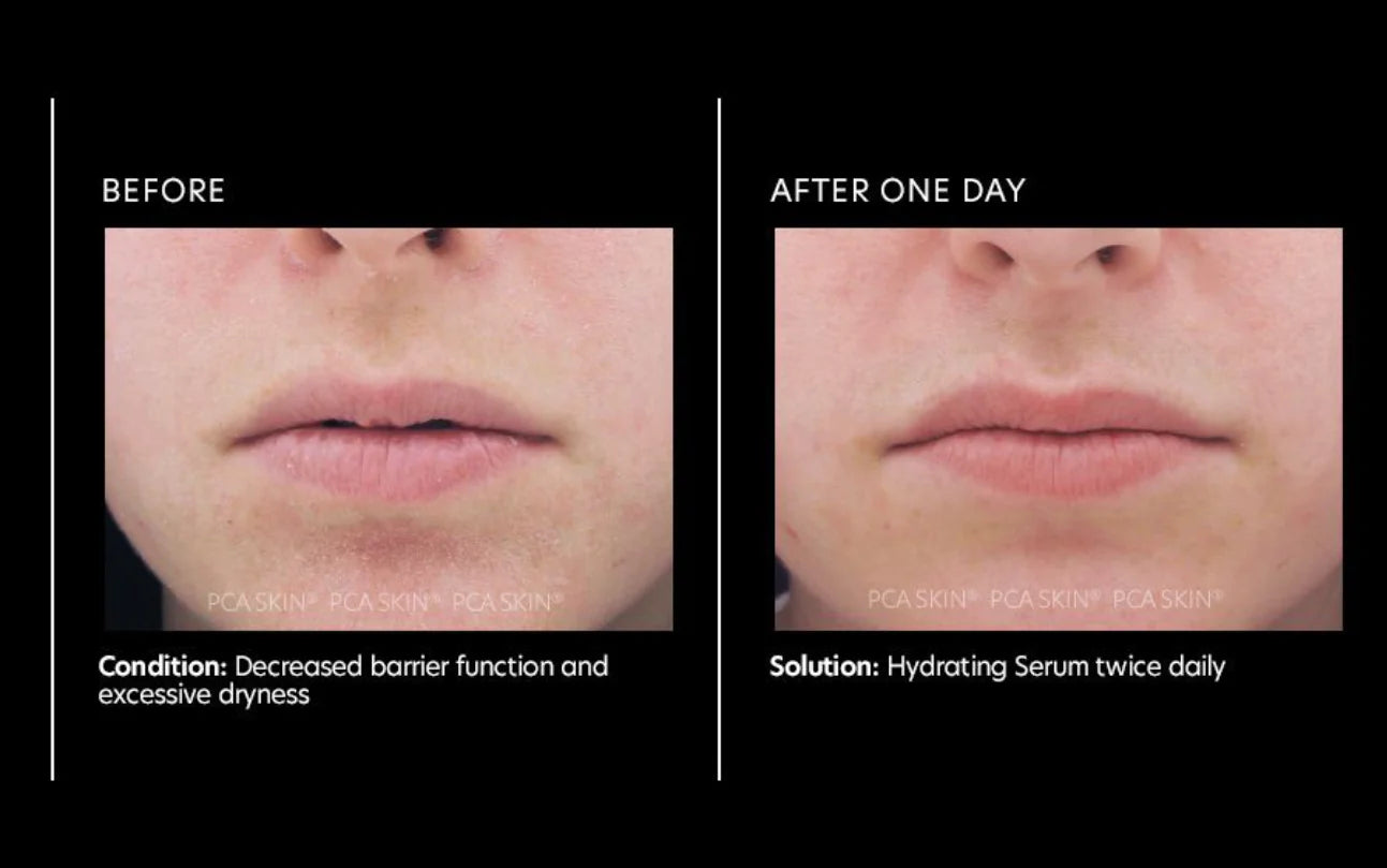 PCA Skin Hydrating Serum 29.5ml