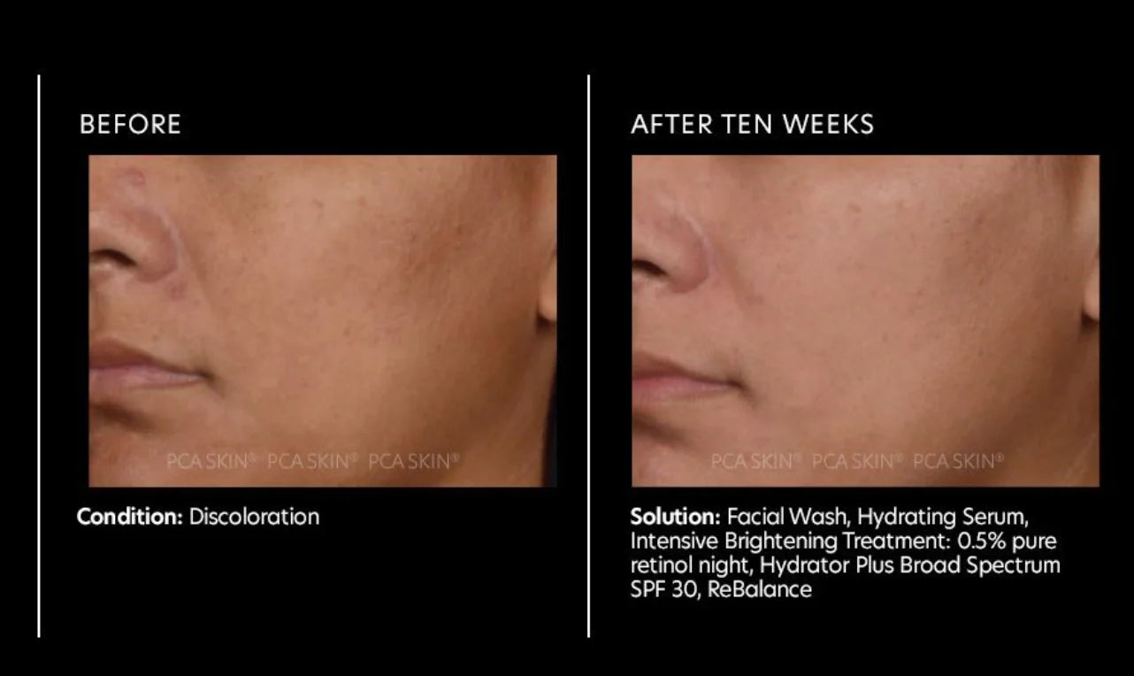 PCA Skin Intensive Brightening Treatment®: 0.5% Pure Retinol Night 29.5g