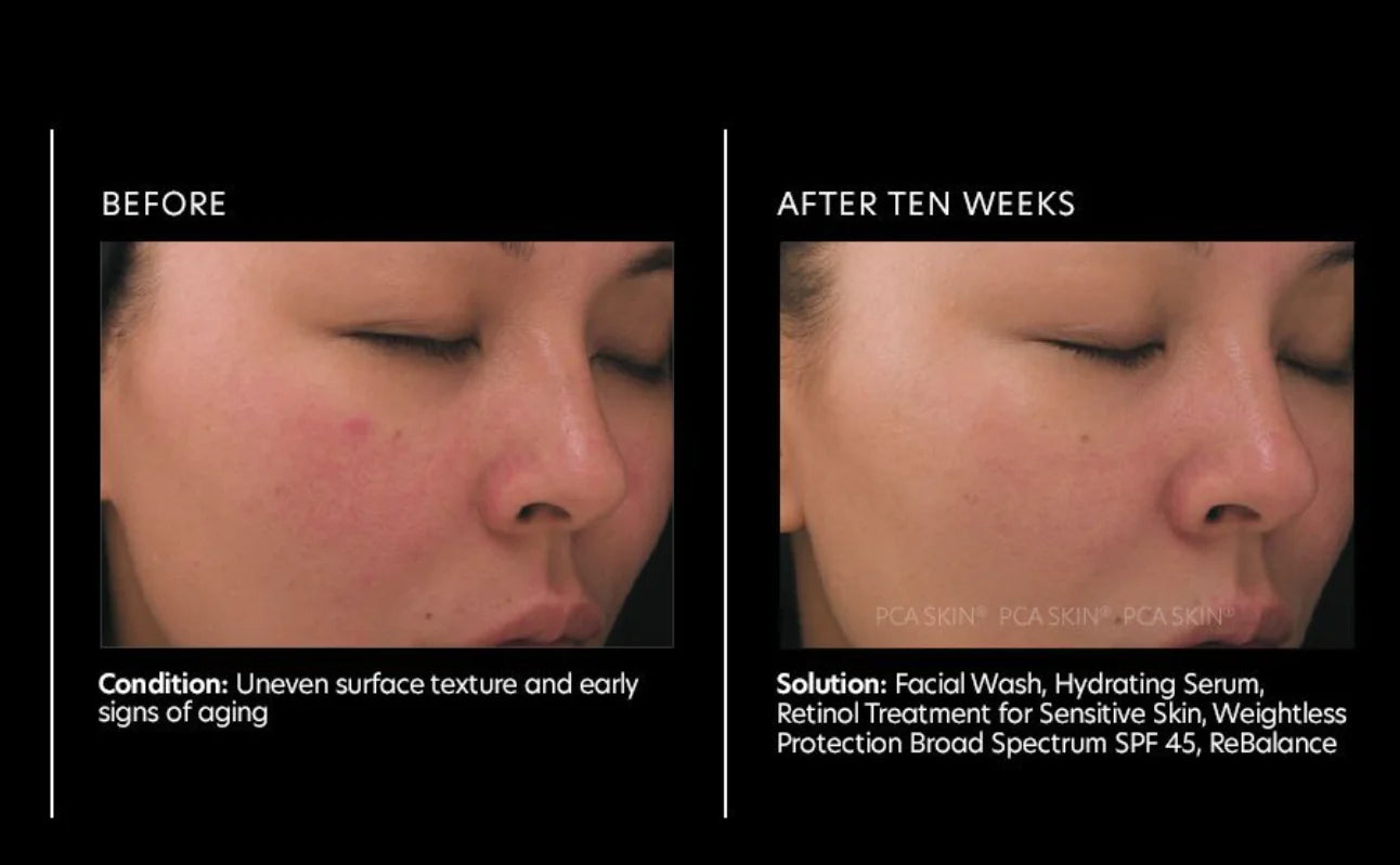 PCA Skin Retinol Treatment for Sensitive Skin 29.5g